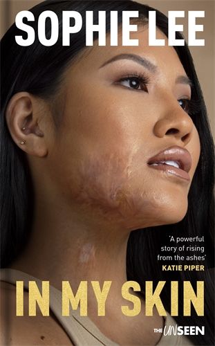 'In My Skin